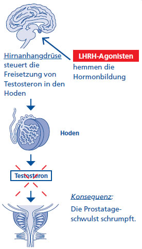 Hormontherapie Lhrh Analoga